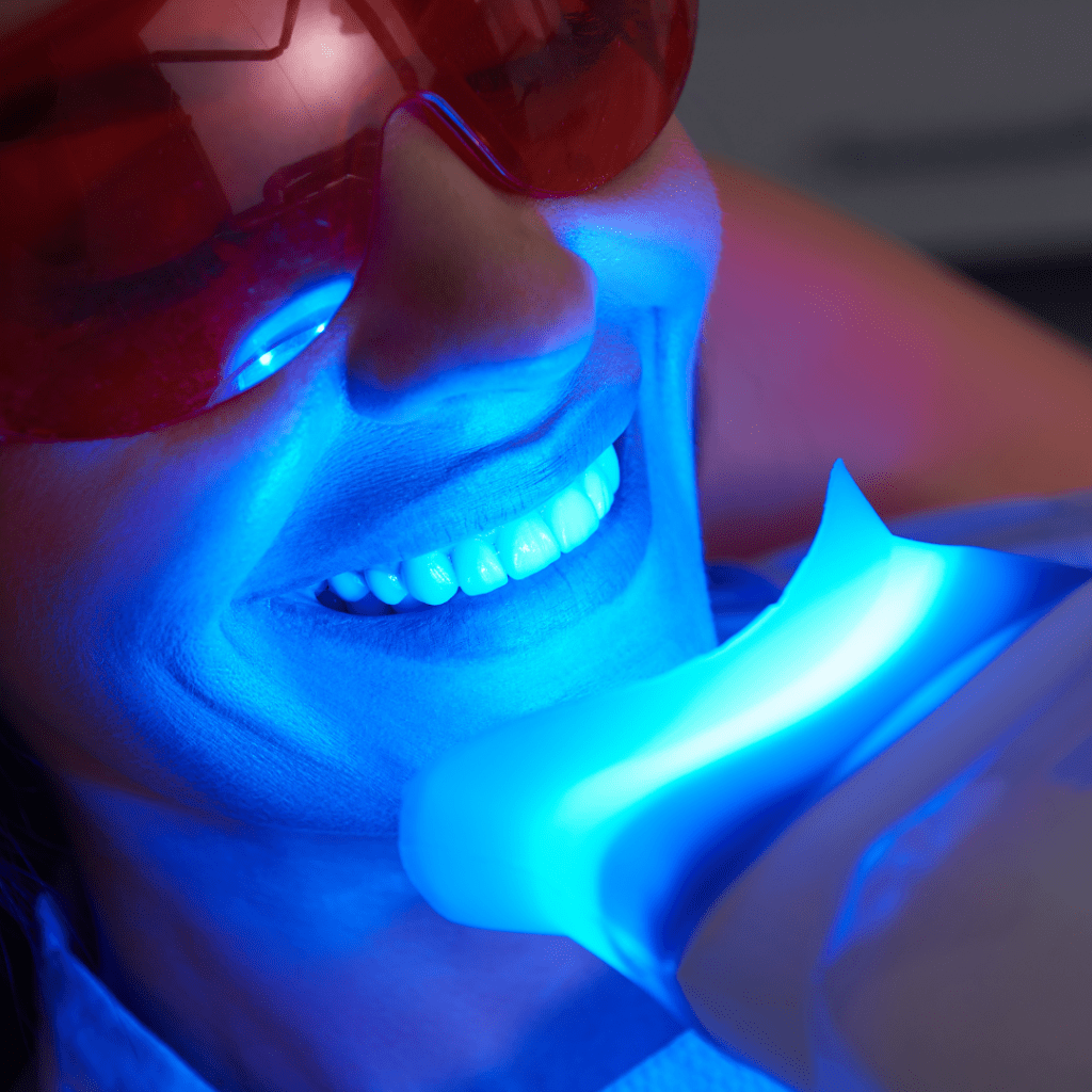 הלבנת שיניים בשיטת ZOOM | מרפאת שיניים ד"ר שאדי עיאדאת |